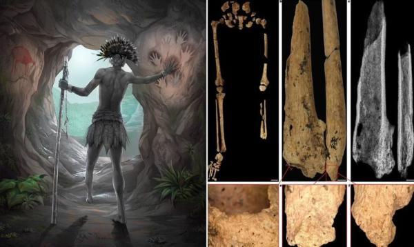 اولین جراحی قطع عضو تاریخ؛ نوجوانی که 31،000 سال پیش پای چپش را به جراح سپرد