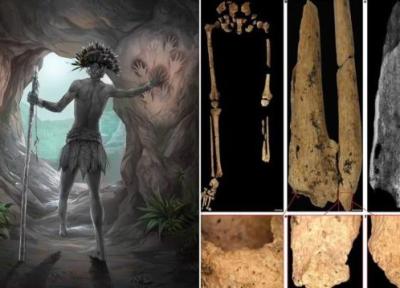 اولین جراحی قطع عضو تاریخ؛ نوجوانی که 31،000 سال پیش پای چپش را به جراح سپرد